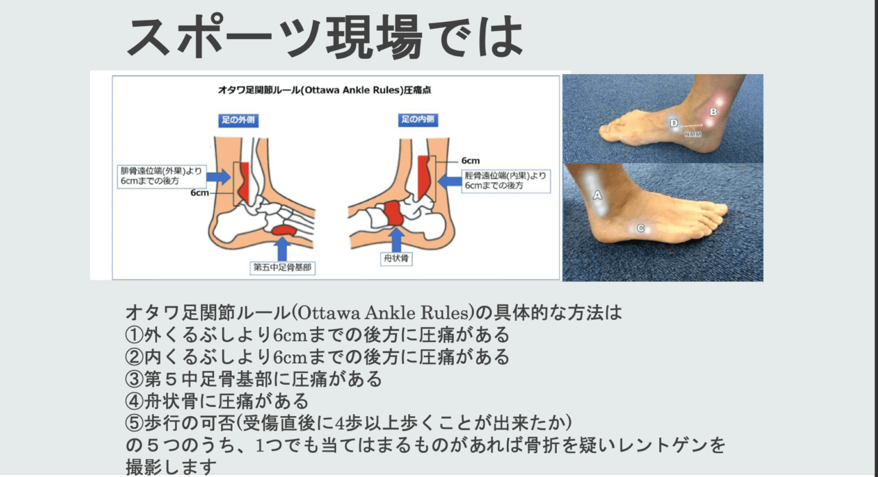 学生トレーナー必見 足関節捻挫のアスレティックリハビリテーション Gap勉強会